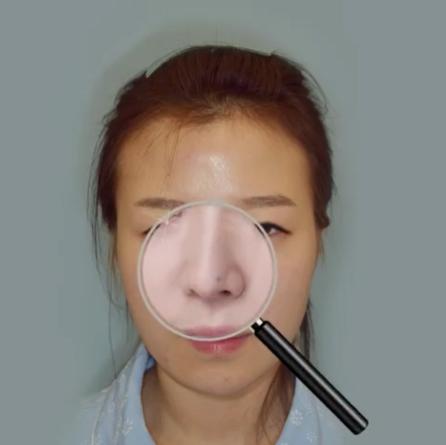 자연스러우면서 확실한 성형수술!
