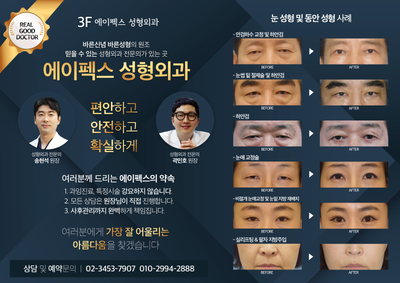 바른 신념 바른 성형의 원조 ~에이펙스 성형외과!!