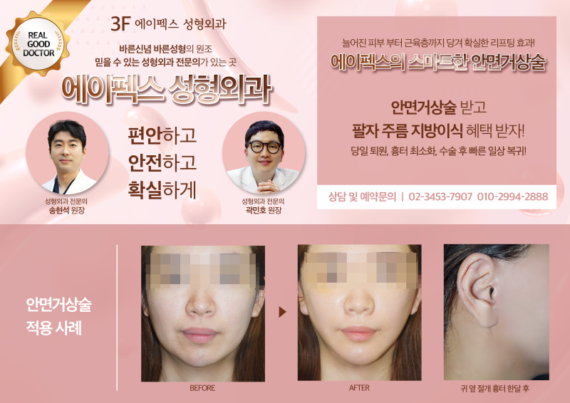 ☆역삼역 성형외과☆ 에이펙스성형외과 ♥봄맞이 새단장