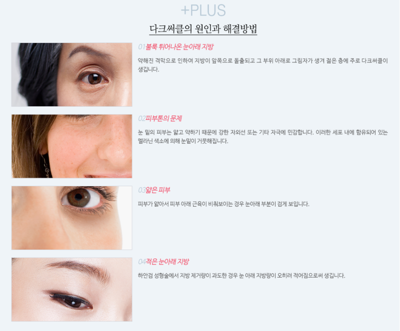 ☆다크써클성형☆ 에이펙스성형외과, 얼굴에 드리운 검은 그림자 이제 환하게!