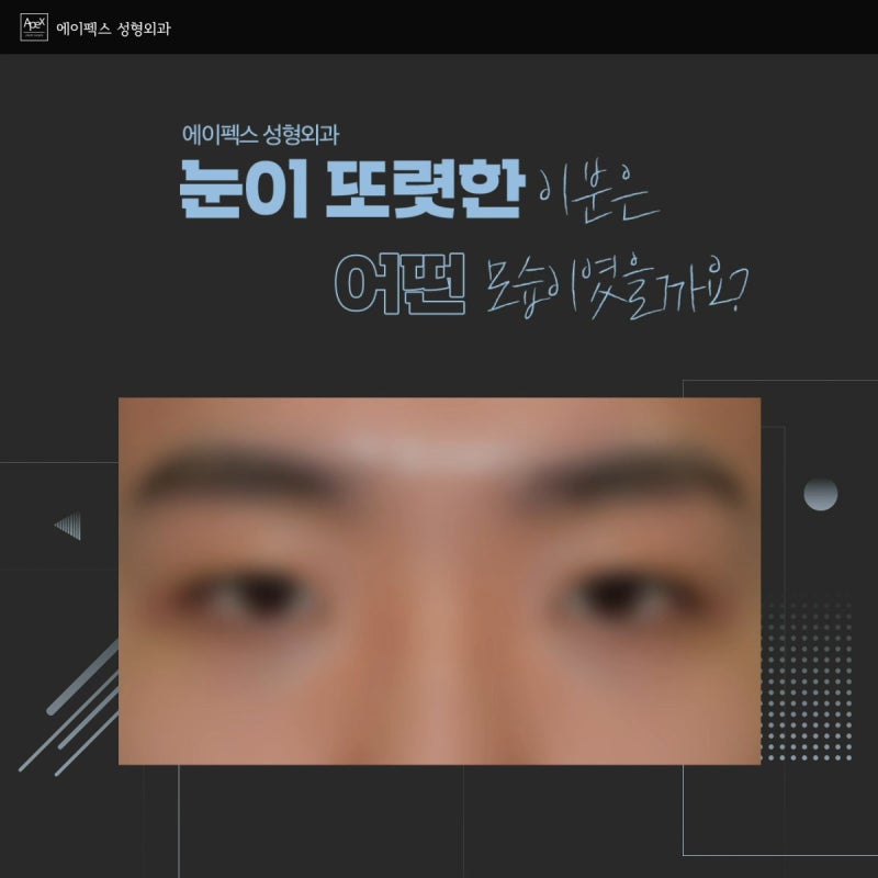 ☆남자성형 추천☆ 에이펙스성형외과! 당당하고 세련된 도시남 되기