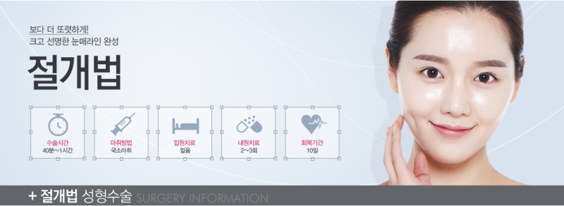 ☆절개 눈성형,쌍커풀 절개☆ 에이펙스성형외과