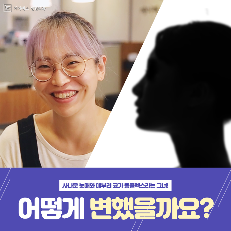 ☆에이펙스성형외과☆ 리얼모델 리얼스토리 애프터 공개 전 3차 인터뷰