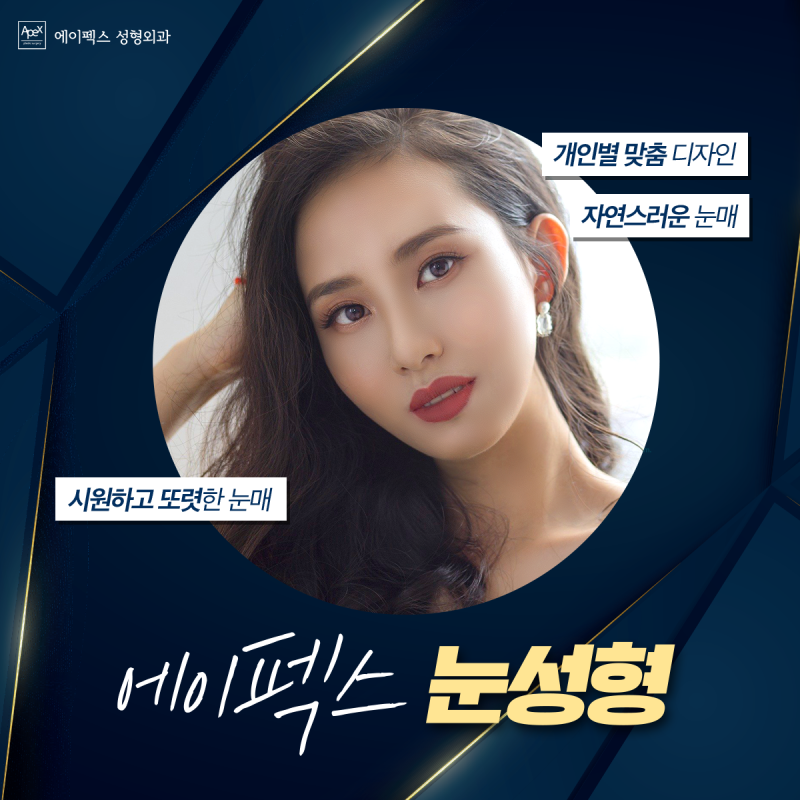 에이펙스성형외과 ☆쌍커풀수술 성형모델, 리얼모델 모집☆