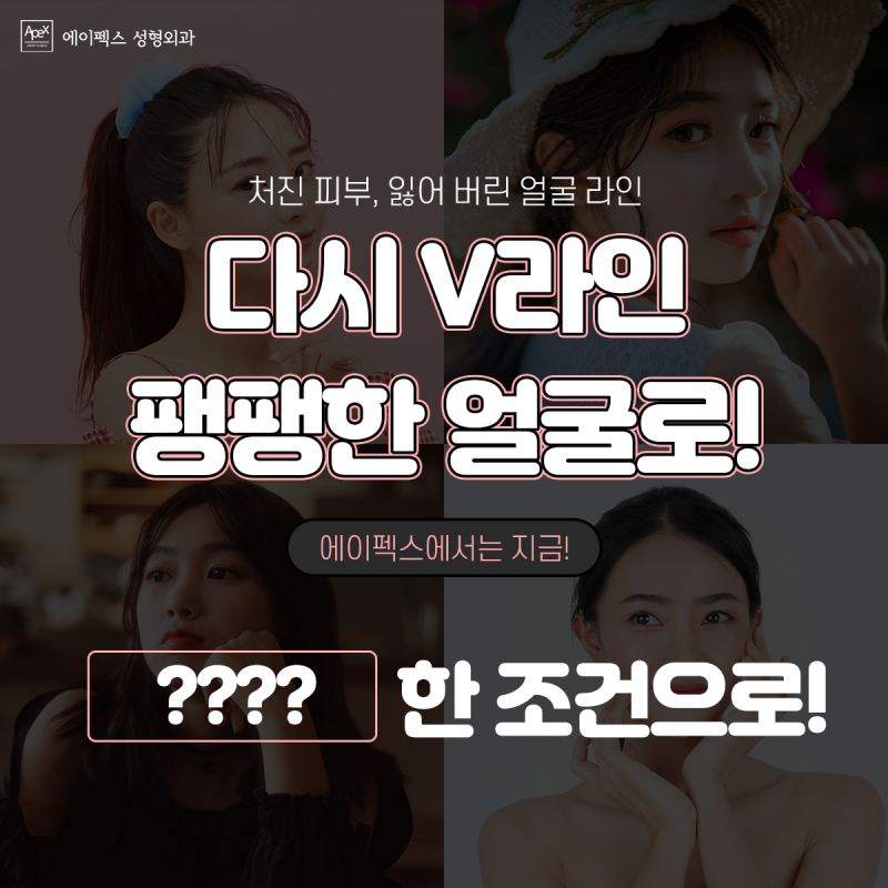 절개리프팅, 실리프팅, 안면거상 ☆에이펙스성형외과☆
