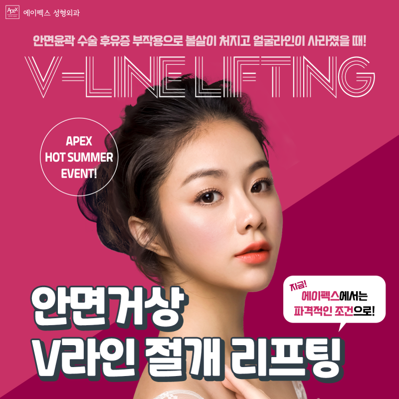 ☆안면거상, 상안검, 이마거상☆ 에이펙스성형외과에서 시작하는 타임리턴