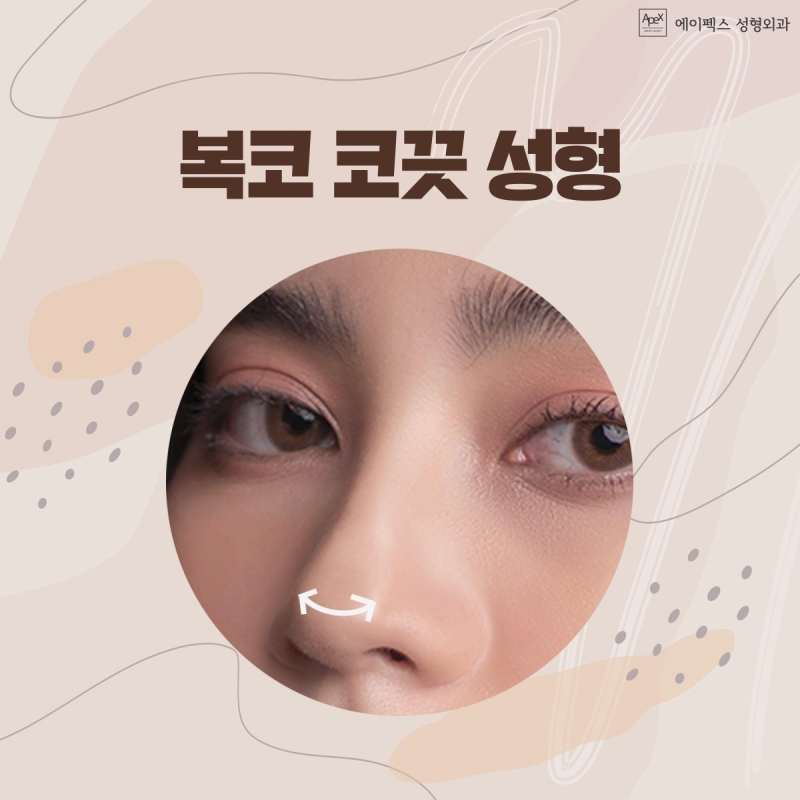 낮은코, 매부리코, 긴코, 휜코 성형 ☆코성형☆ 에이펙스성형외과