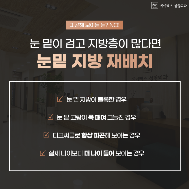 다크써클, 눈밑지방재배치 ☆에이펙스성형외과☆