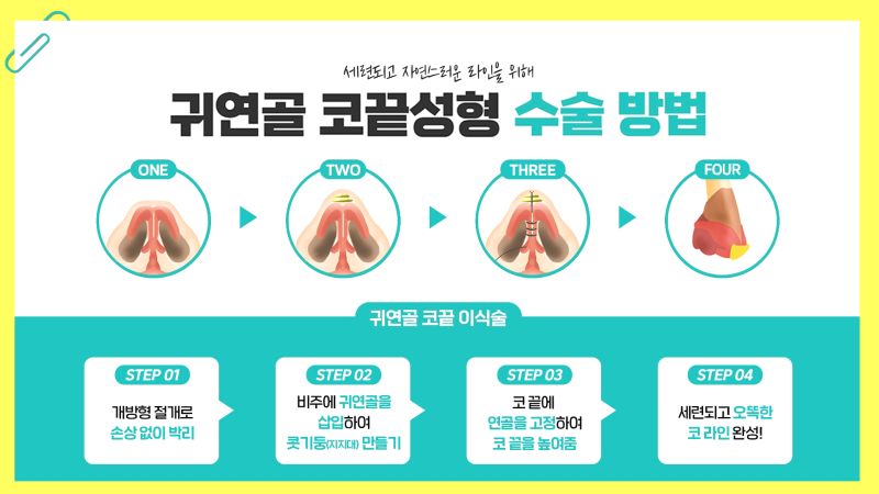 에이펙스성형외과 자가조직을 이용한 "귀연골 코끝성형"