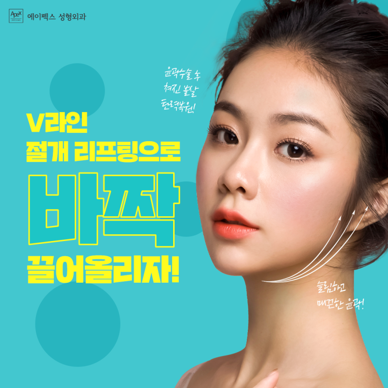 날렵하고 처짐없는 V라인 얼굴 "에이펙스 안면거상" 페이스리프팅