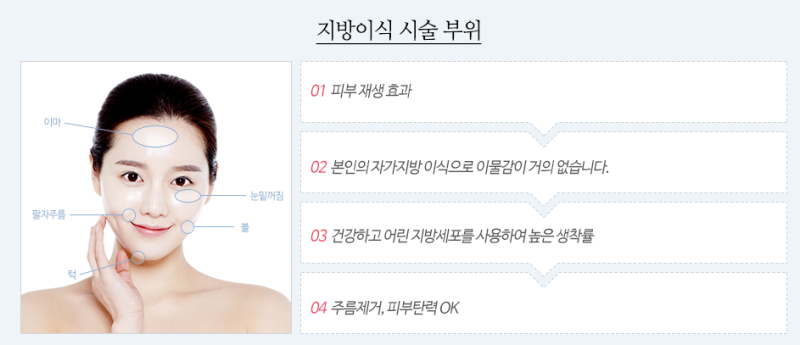 갖고 싶다 "얼굴볼륨" 입체적인 동안얼굴 ☆에이펙스성형외과☆