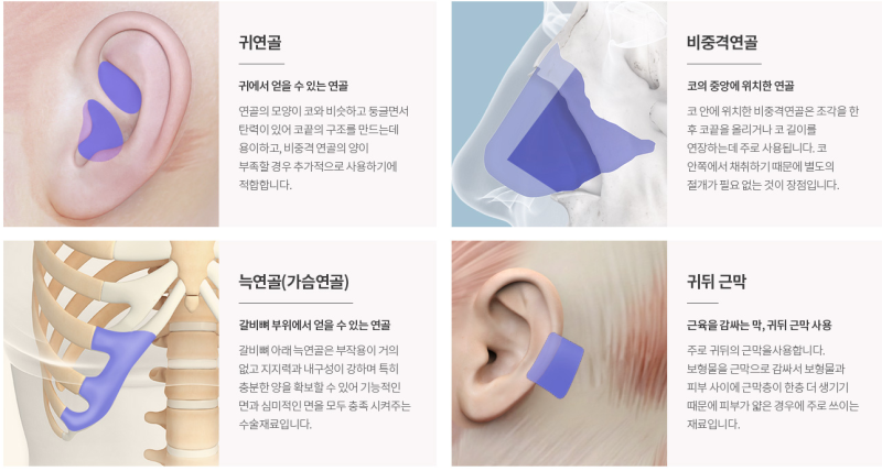 높이부터 다른 확실한 코성형 "에이펙스성형외과"
