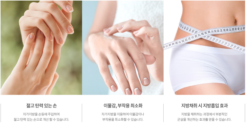 "손등 지방이식, 손가락 지방이식" 손도 젊고 예쁘게! 에이펙스성형외과