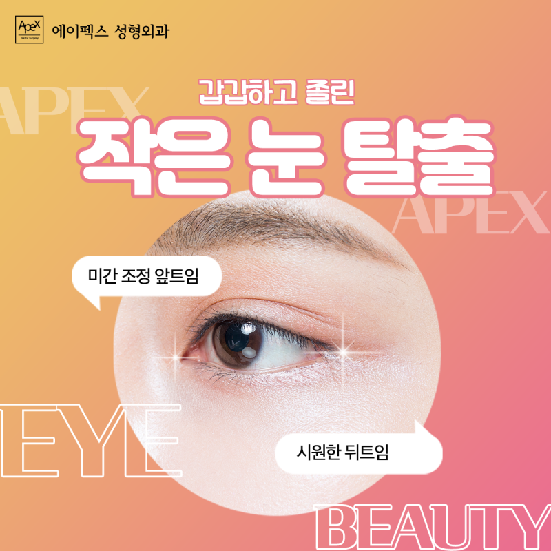 가로, 세로 눈길이를 시원하게! 트임성형, 에이펙스성형외과