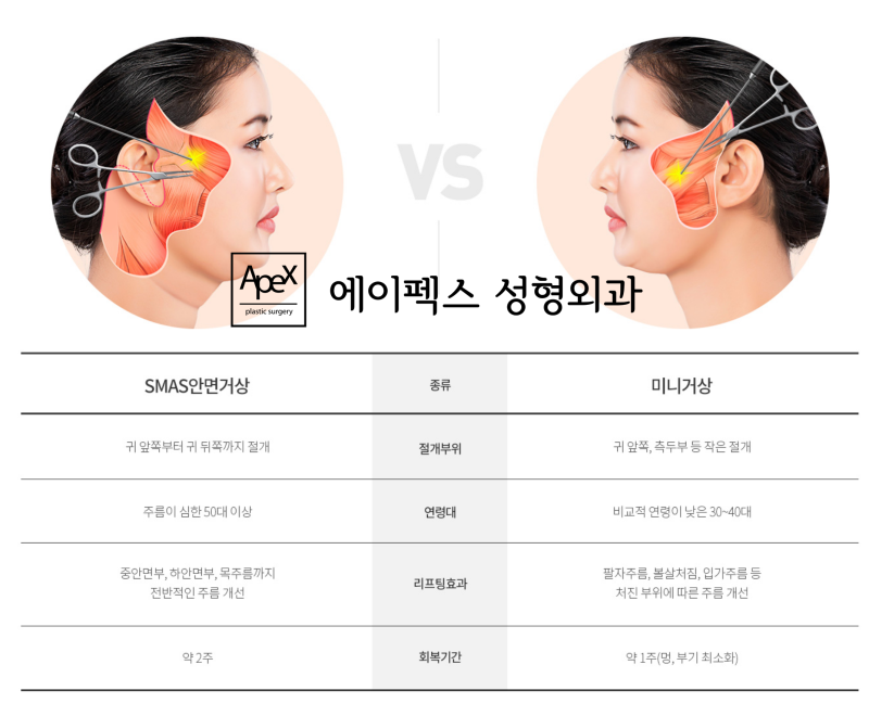 갸름한 페이스라인, 매끈한 턱선, V라인 안면거상 "에이펙스성형외과"