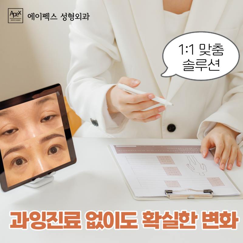 성형에 대한 모든 정보, 에이펙스성형외과에 다 있다!
