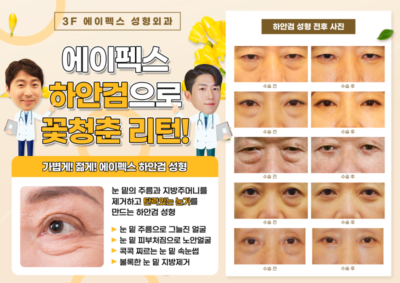 동안성형, 에이펙스성형외과에서 맞이하는 두번째 스무살 & 세번째 스무살