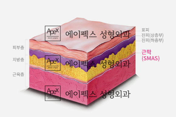 강력한 얼굴리프팅, 한번에 확실하게 끌어올리는 에이펙스성형외과 안면거상