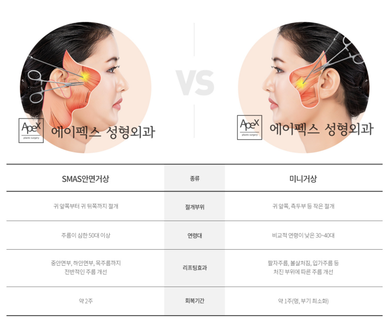 에이펙스성형외과, 날렵한 턱선, 탄력있는 V라인 "안면거상"