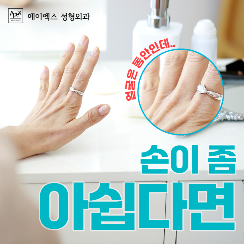 보들보들 예쁜 손, 에이펙스성형외과 손등&손가락 지방이식