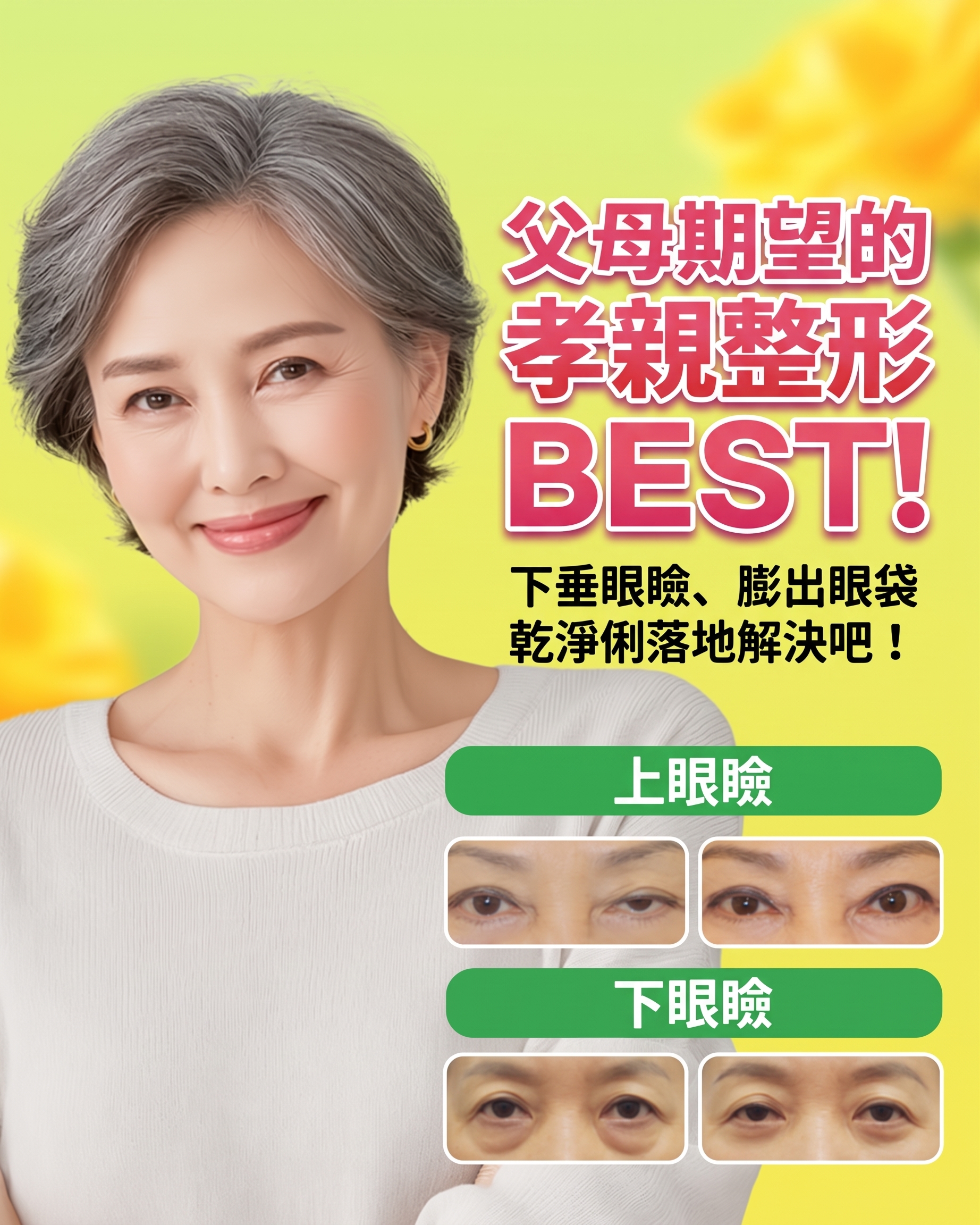 60歲以上，眼皮下垂與凸出眼袋｜艾佩克斯整形外科 上眼瞼&下眼瞼
