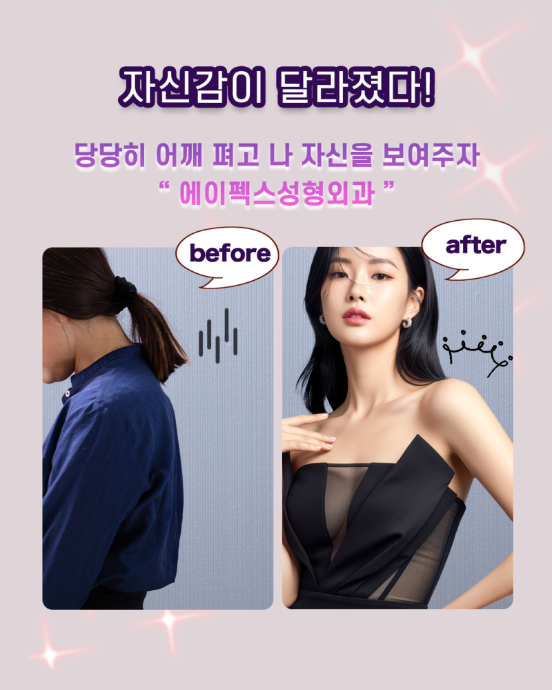 에이펙스성형외과, 넘치는 자신감으로 솔로탈출을 위한 가장 빠른 솔루션 사진 11