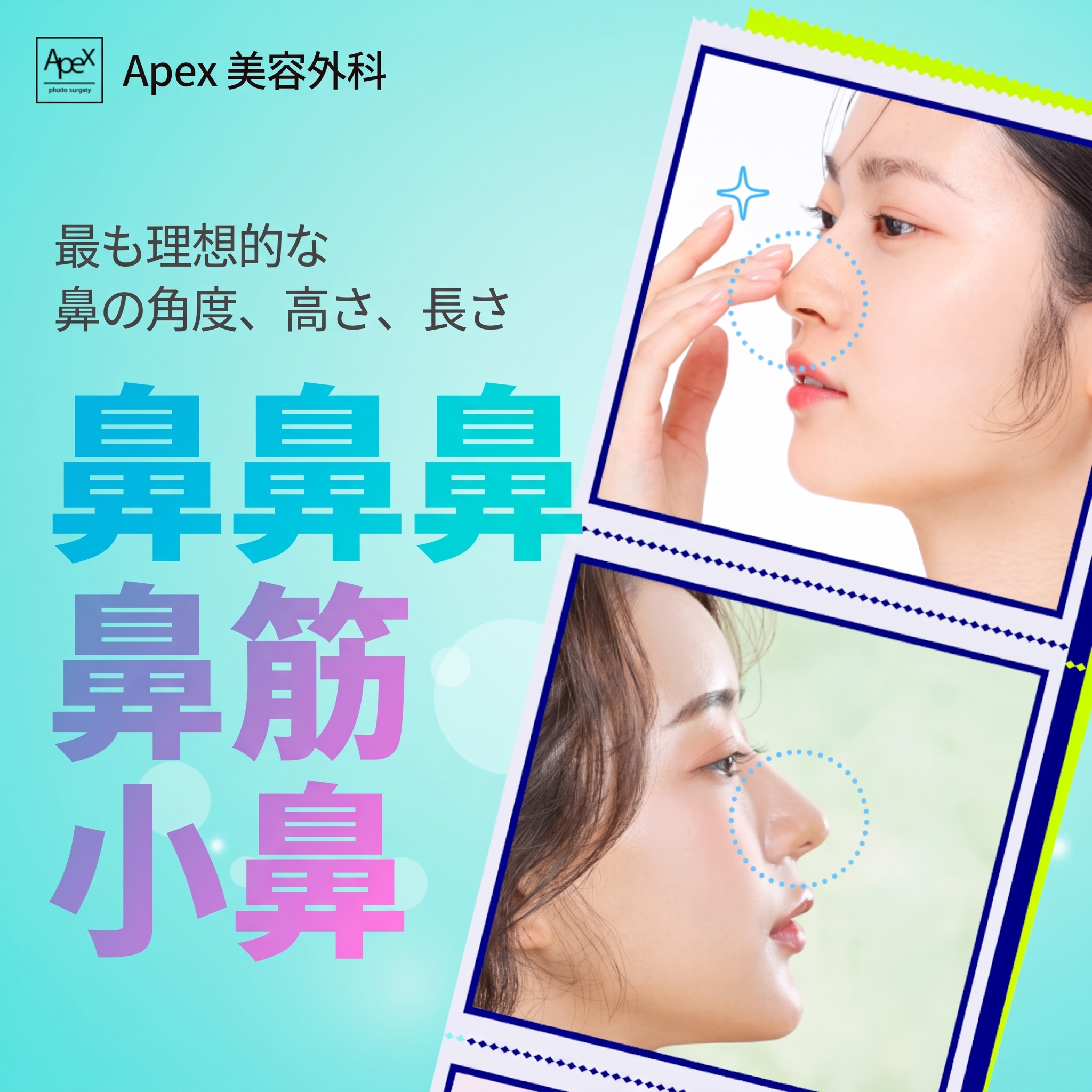 鼻先形成、小鼻縮小、立体的な顔立ちのための鼻整形「エイペックス美容外科」 사진 4
