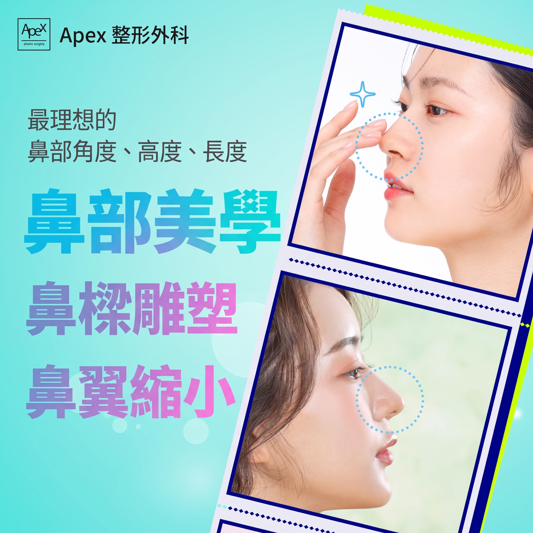 鼻頭整形、縮鼻翼，打造立體精緻輪廓的隆鼻手術「APEX整形外科」 사진 4