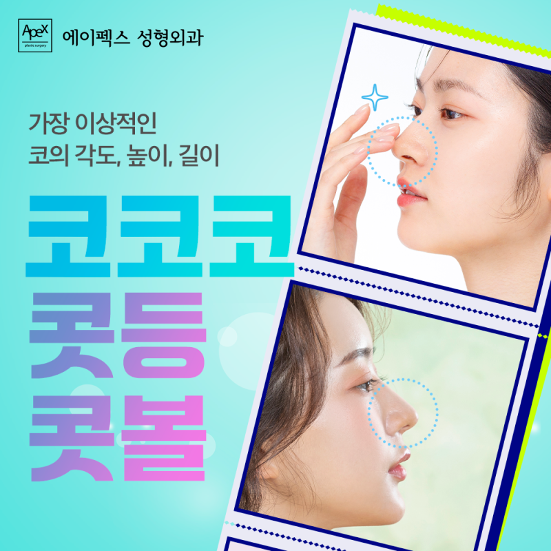 코끝성형, 콧볼축소, 입체적인 얼굴을 위한 코성형 "에이펙스성형외과" 사진 4